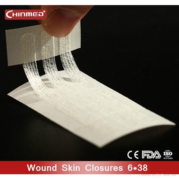 disposable surgical Wound skin closure 2