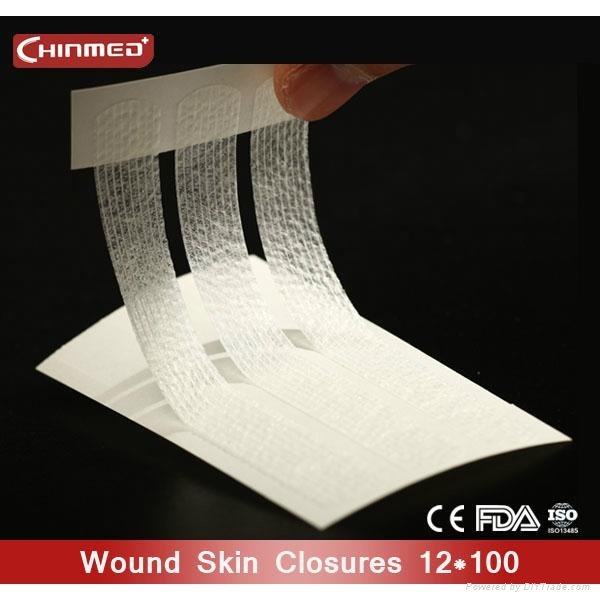 disposable surgical Wound skin closure 3