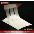 disposable surgical Wound skin closure 3