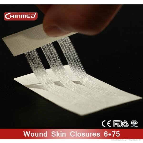 disposable surgical Wound skin closure 4