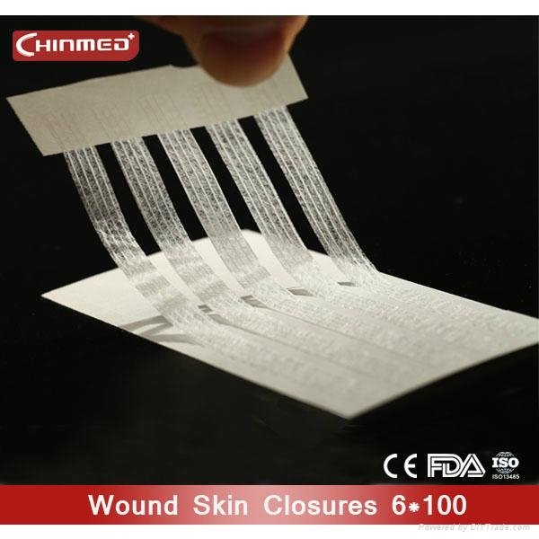 disposable surgical Wound skin closure 5