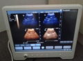 15'' Touch Screen High Resolution Portable Ultrasound Scanner Ultrason 3