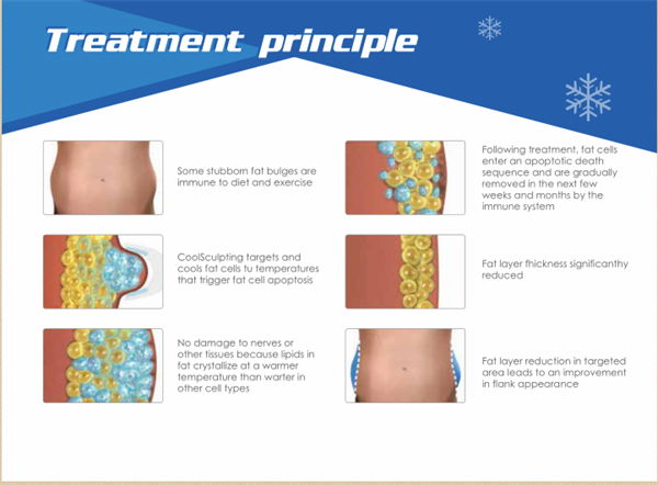 Slimming Machine Ultrasonic Cavitation cryopolysis 4