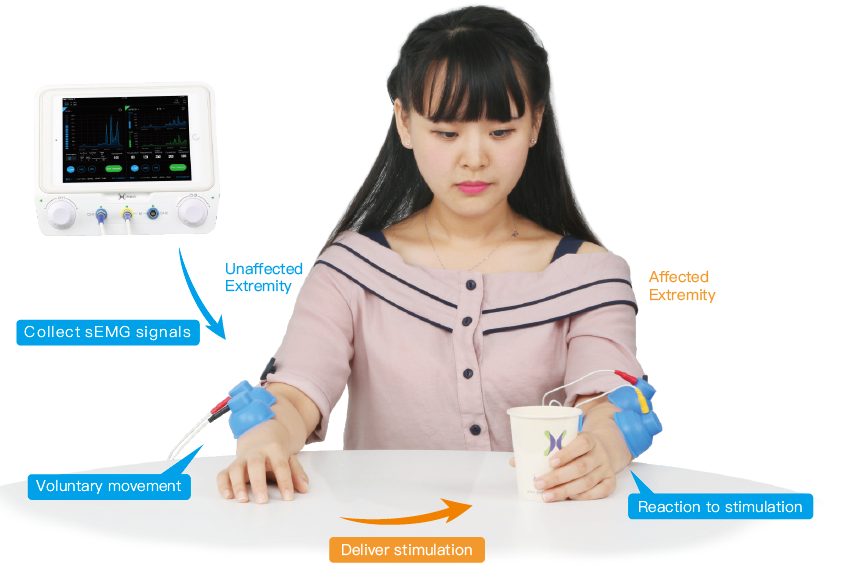functional electrical stimulation functional electrical stimulation