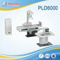 X ray system digital fluoroscope