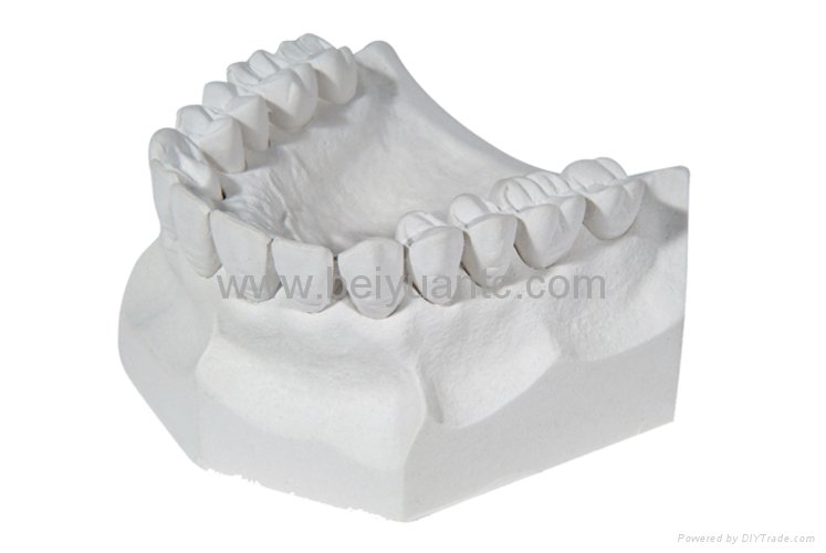 Type III dental plaster for model 2
