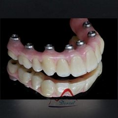 Dental Implant Hybrid Denture
