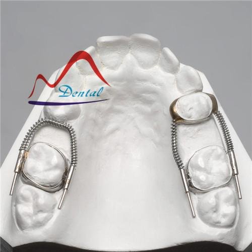 Dental Space Retainer Band Looped 3