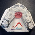 Dental Space Retainer Band Looped