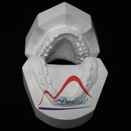 Hand-sculpted Dental Orthodontic Model 3