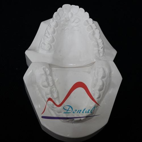 Hand-sculpted Dental Orthodontic Model 2