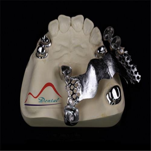 Durable Dental Telescopic Crown 5