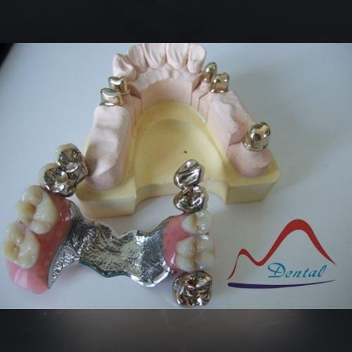Durable Dental Telescopic Crown 3