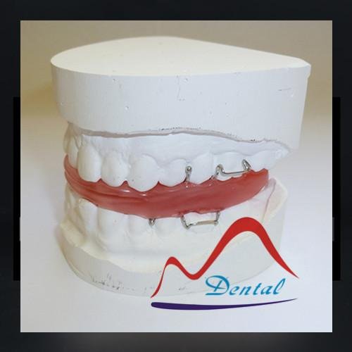 Frankel orthodontic dental Appliance 2