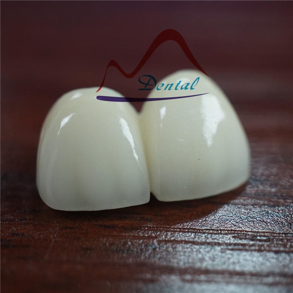 Dental Digital printed model for E-max crown
