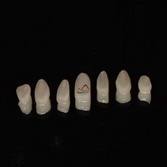Dental All Ceramics CC Veneers
