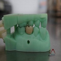 3D Printing Zirconia Ceramic Crown