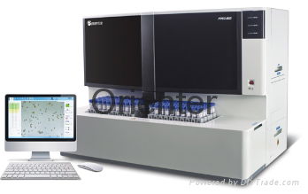 Diagnostics Automated Feces Analyzer and Processing for stool detection
