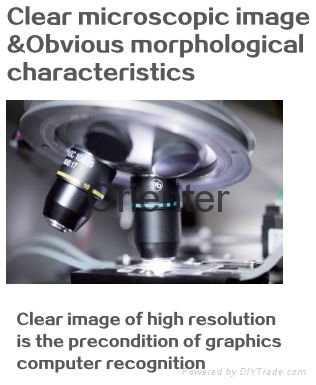 Biochemical Laboratory Automated Fecal  Analyzer for feces detecition 3