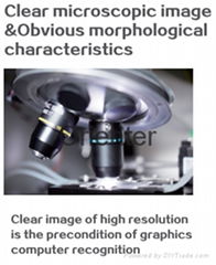 Body Fluid Testing Automated Stool Analysis and Processing for fecesl detection