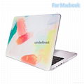 For Macbook High Quality Case  New Design Cover  4