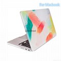 For Macbook High Quality Case  New Design Cover  3