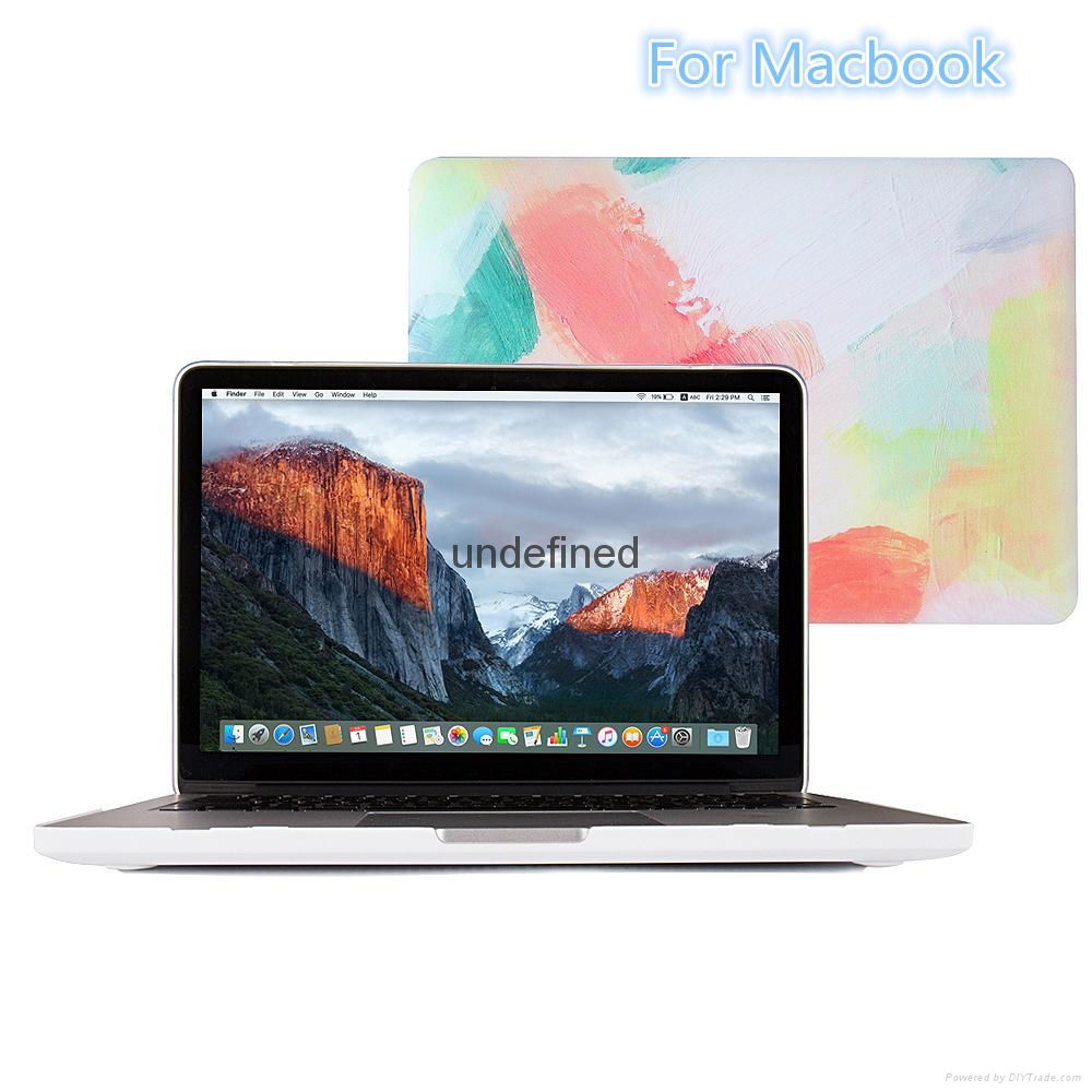 For Macbook High Quality Case  New Design Cover 