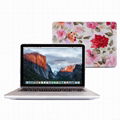 Macbook Pro New Crystal Transparent Rose Hard Case 12.13 Inch Laptop Bag 1