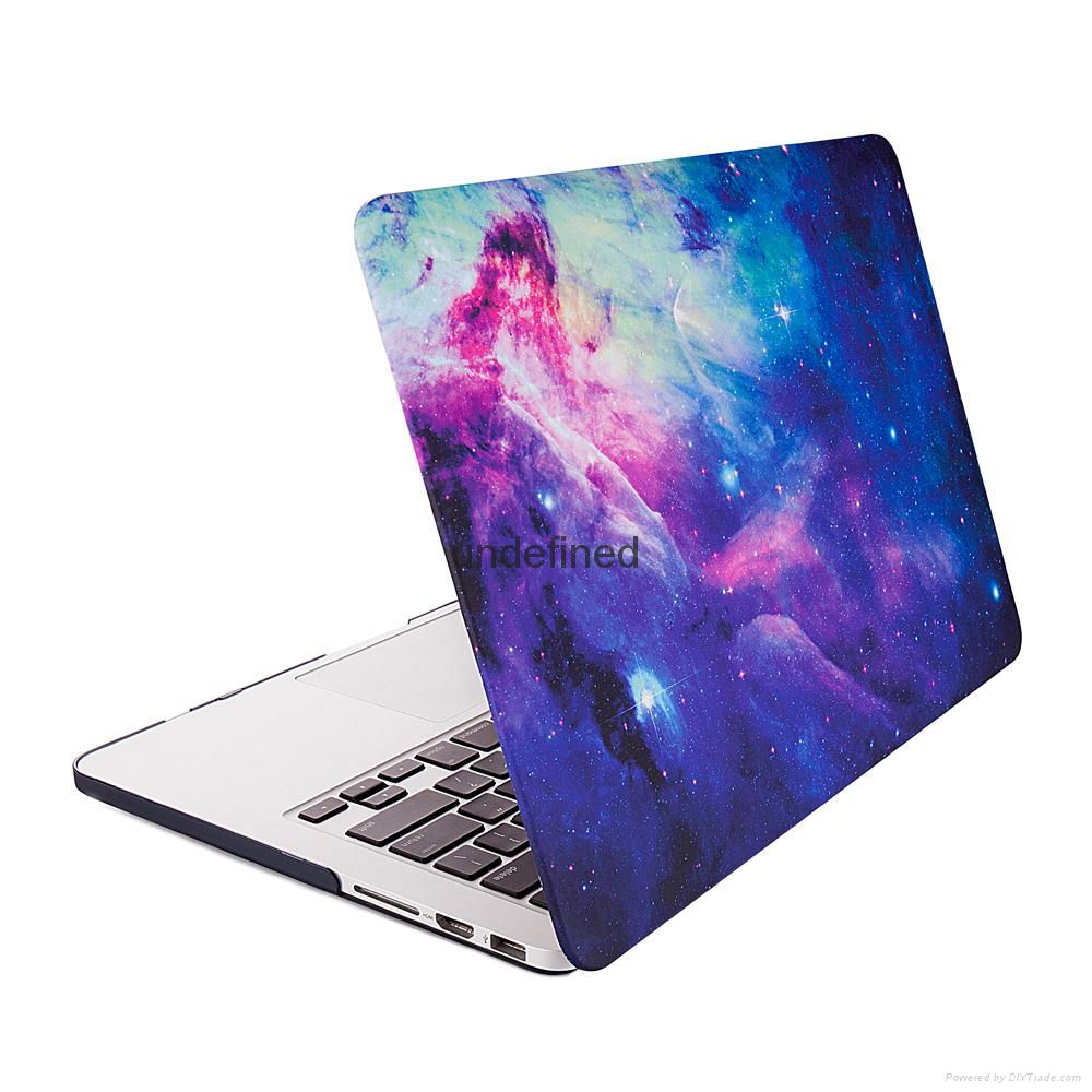 OEM European Style Case For Macbook, Printed Hard Shell PC Plastic Case For Macb 4