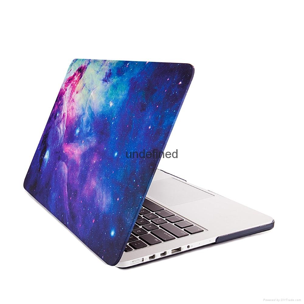 OEM European Style Case For Macbook, Printed Hard Shell PC Plastic Case For Macb 2