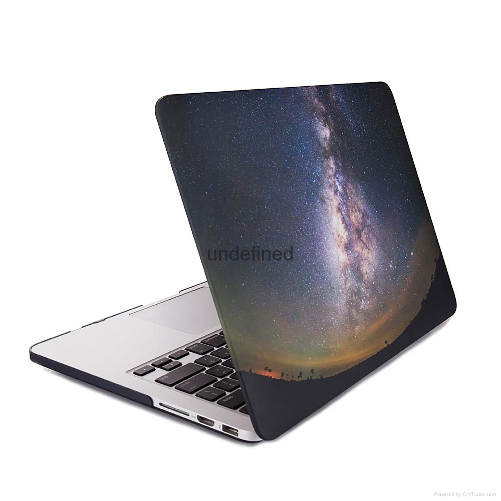 For MacBook 12-inch best-selling Galaxy design, fully protected MacBook 12-inch  2