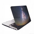 For MacBook 12-inch best-selling Galaxy design, fully protected MacBook 12-inch  2