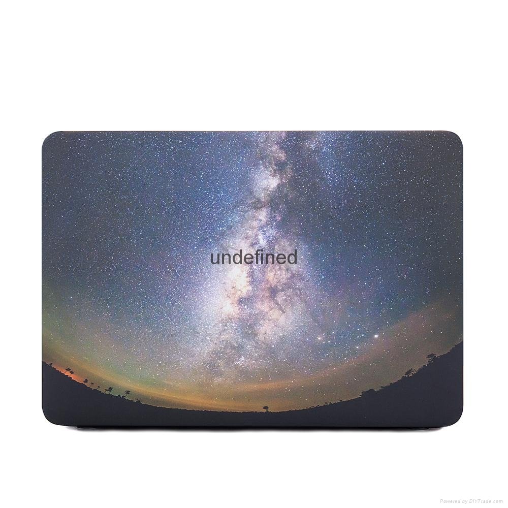For MacBook 12-inch best-selling Galaxy design, fully protected MacBook 12-inch 