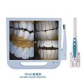 LCD Monitor Screen Dental Intraoral Camera with Wired