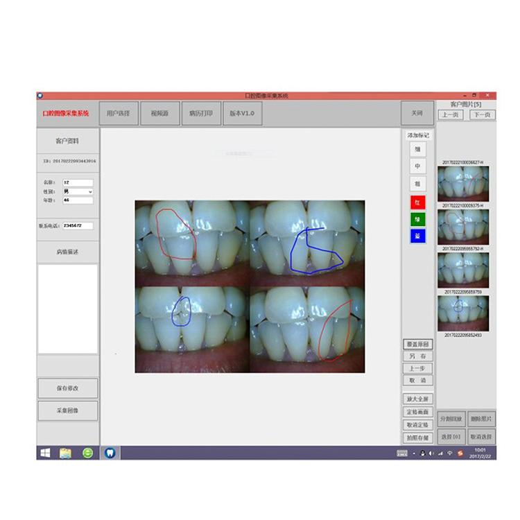 High Defination Dental Endoscrope Integrated Intraoral Came 2