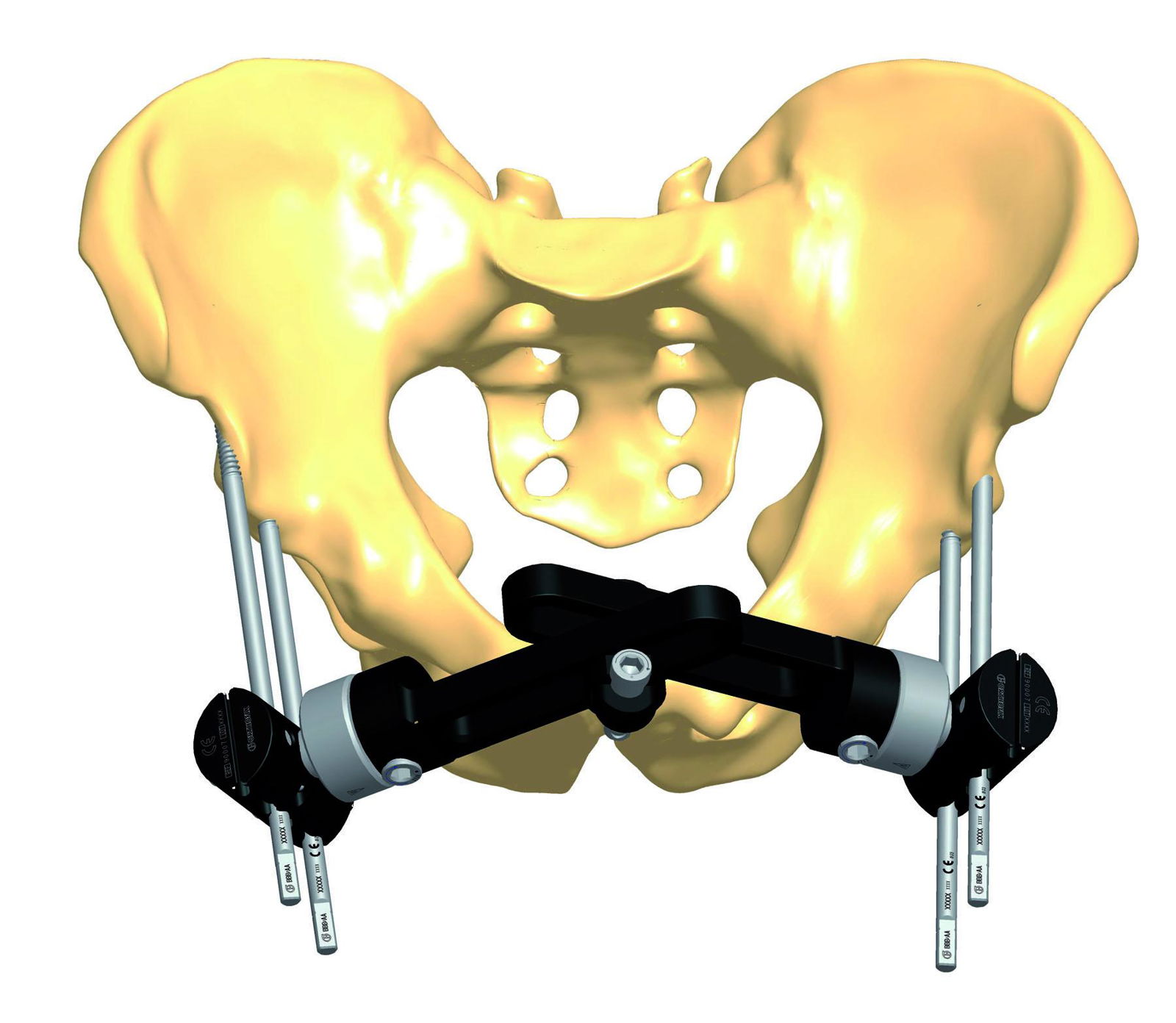 Pelvic Fixator 2