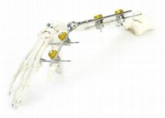 SK Combined External Fixator(Small Bone)
