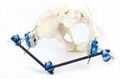 SK Combined External Fixator(Large Bone)