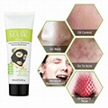 acne remover 4