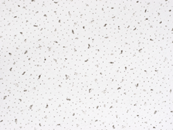 Acoustic Ceiling Board Price Philippines China Manufacturer