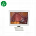 Medical endoscope ccd camera