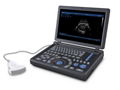 Canyearn A15 Full Digital Laptop Ultrasonic Diagnostic System 1