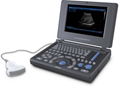 Canyearn A10 Full Digital Laptop Ultrasonic Diagnostic System 1