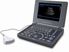 Canyearn A10 Full Digital Laptop Ultrasonic Diagnostic System