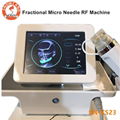 Fractional Micro Needle RF Beauty Machine for Wrinkle Removal 3