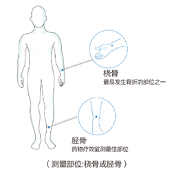 超聲波骨密度儀7000+