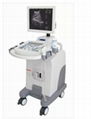 Trolly Ultrasound Diagnostic System