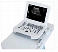 Laptop Ultrasound Machine Specifications ZERO-500 1