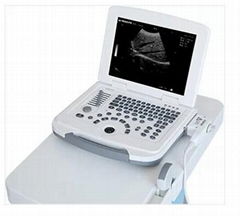 Laptop Ultrasound Machine Specifications ZERO-500