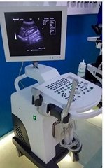 Trolly Ultrasound Diagnostic System ZERO-370